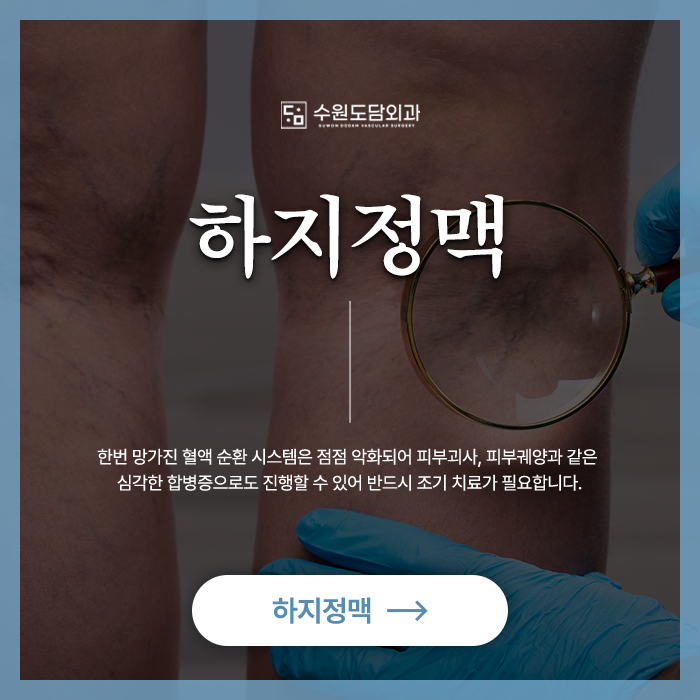 수원 하지정맥류 수술 치료 도담외과